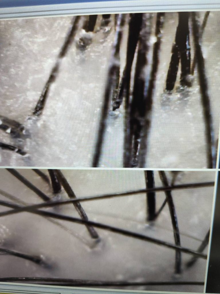 台中頭皮護理推薦|頭皮SPA去角質舒壓流程實拍